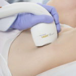 Laser Hair Removal in New Paltz and Highland